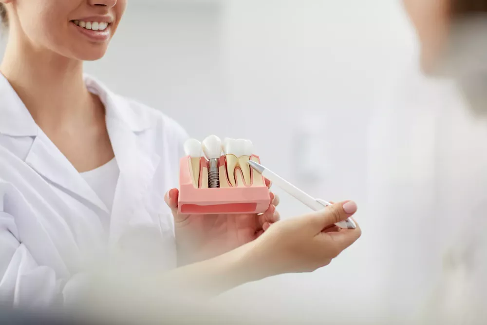 stomatolog z modelem implantów zębowych